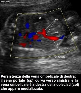 Le vene il trattamento fisso fa male e ha funzionato